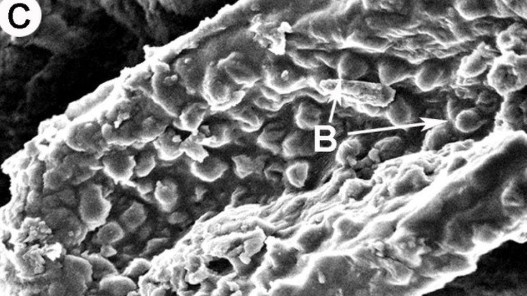 bacteria dos