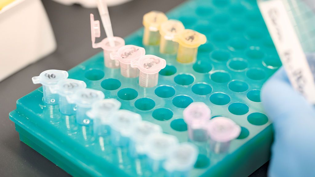 Tecnología y dinero: dos motivos que explican por qué las vacunas contra el coronavirus llegarán tan rápido Tecnología y dinero: dos motivos que explican por qué las vacunas contra el coronavirus llegarán tan rápido