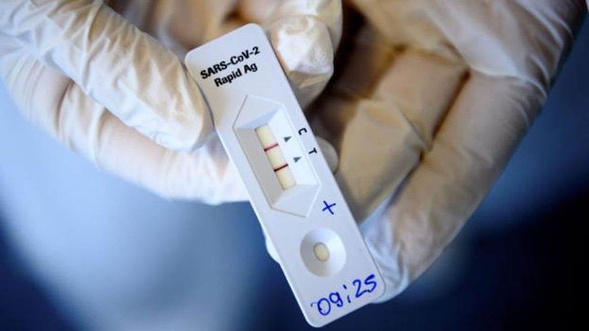 Los falsos negativos detectados en pruebas de antígenos no son contagiosos