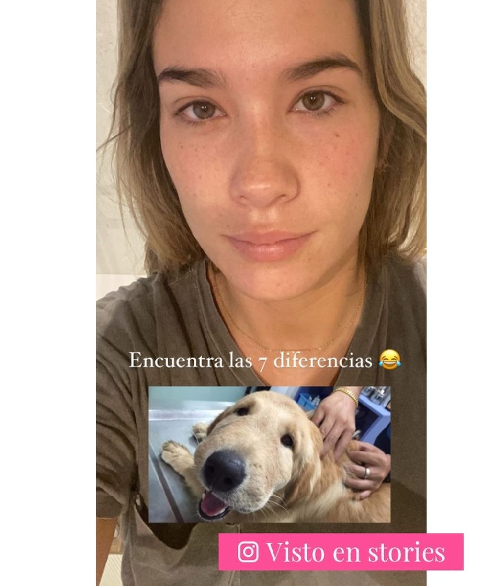 El rostro de María Pombo hinchado por la retención de líquidos