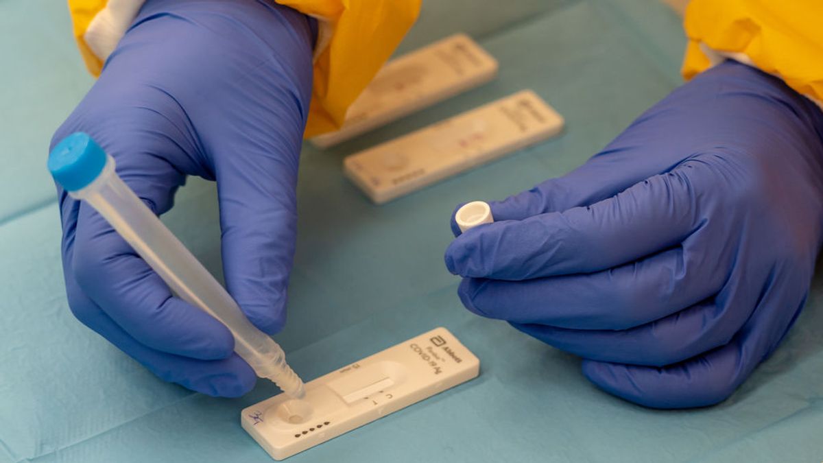 La propuesta de hacer test de coronavirus en las farmacias provoca dudas y roces