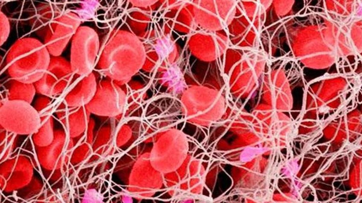 Aplicar dosis altas de anticoagulantes a enfermos de covid es ineficaz y puede causar la muerte Aplicar dosis altas de anticoagulantes a enfermos de covid es ineficaz y puede causar la muerte