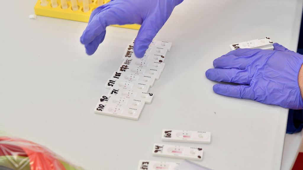 Mitjà, partidario que farmacias vendan test y ciudadanos se los hagan en casa Mitjà, partidario que farmacias vendan test y ciudadanos se los hagan en casa