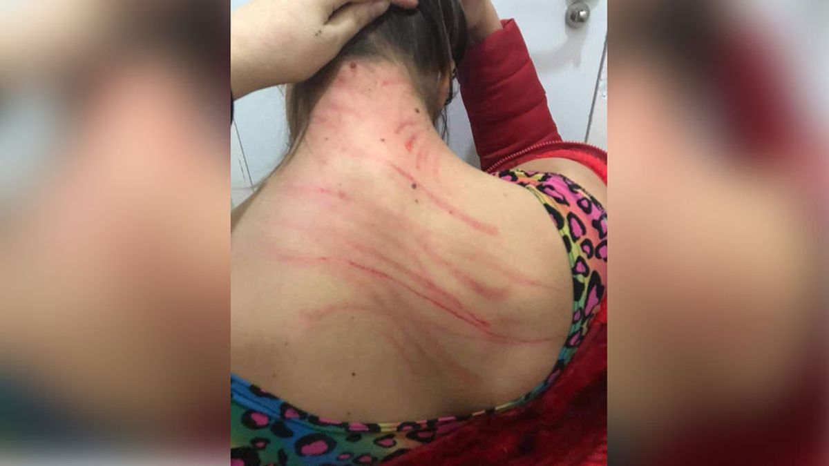 Abusan sexualmente de una joven trans en Madrid y la golpean con un objeto punzante al grito de "estáis muertas"