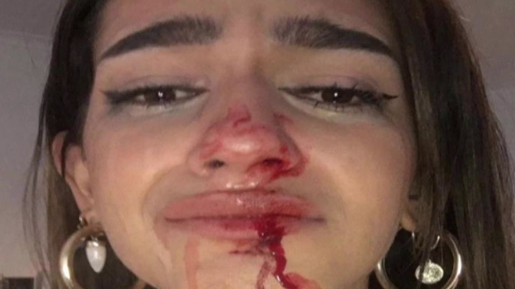 "‘¡Puto travelo! ¡engendro!": una joven denuncia una brutal agresión tránsfoba en Barcelona