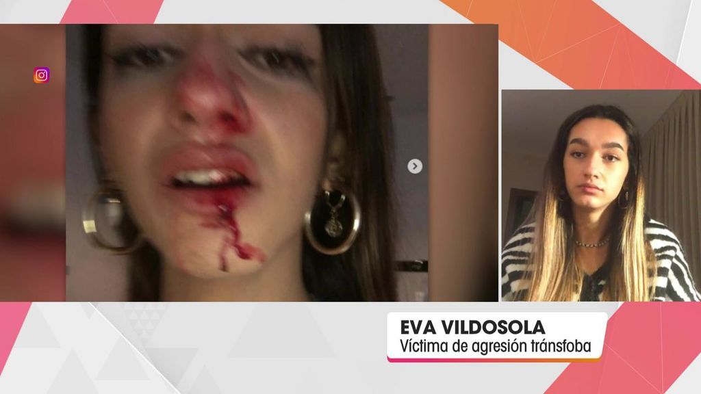 Eva, la joven transexual agredida en Barcelona: