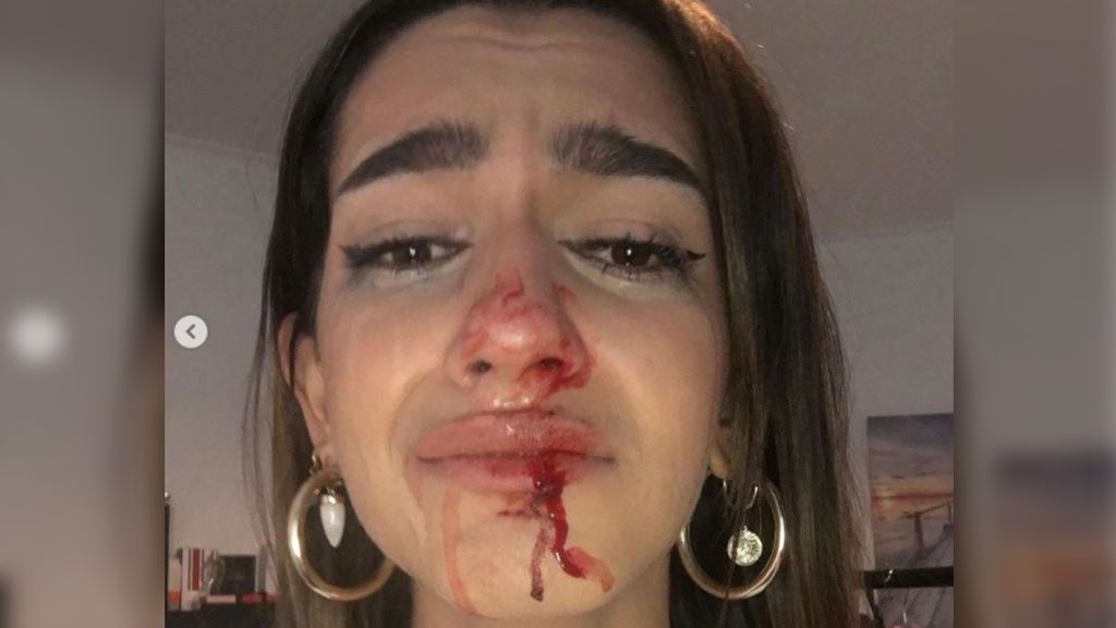 Eva denuncia una agresión: "Me han gritado '¡puto travelo!' y me han dado dos puñetazos en la cara" Eva denuncia una agresión: "Me han gritado '¡puto travelo!' y me han dado dos puñetazos en la cara"