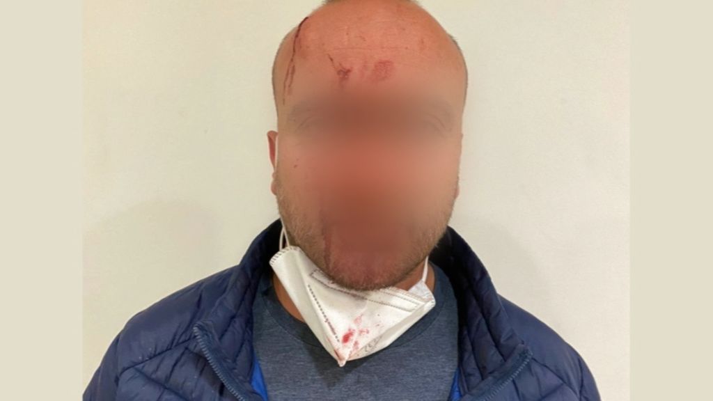 Paliza a dos policías locales por una mascarilla