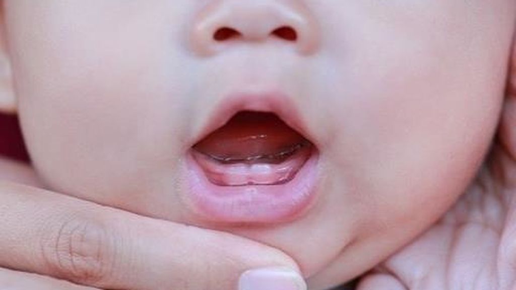 Los dientes pueden comenzar a aparecer a partir de los tres meses de edad.