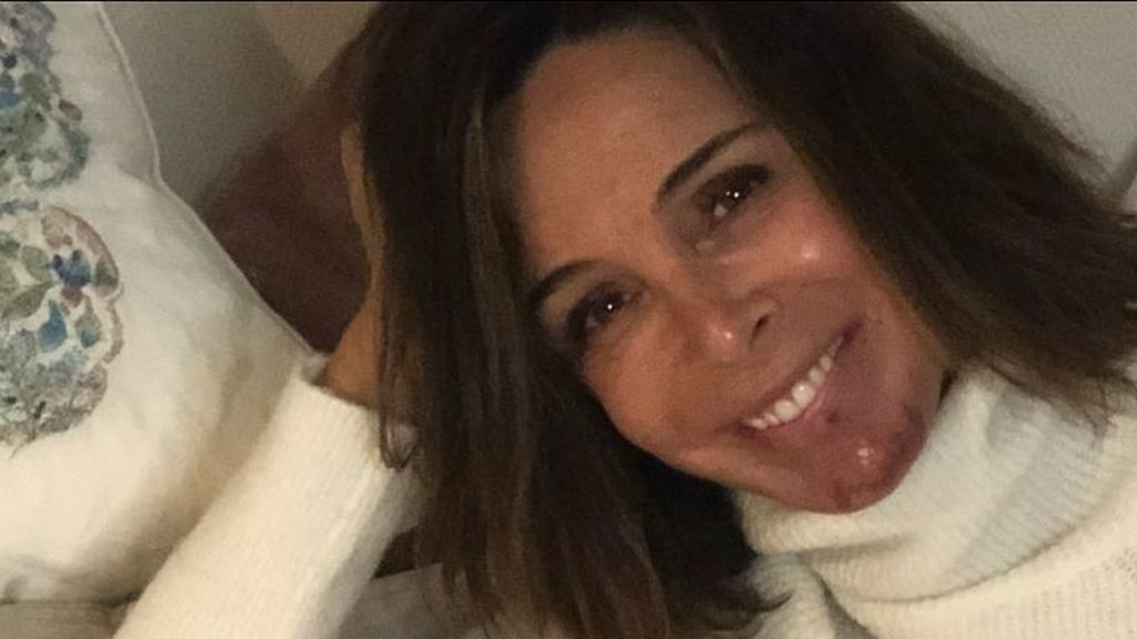 Lidia Bosh cuenta que le han diagnosticado un carcinoma basal en la barbilla: "He comprado todas las papeletas para tenerlo"