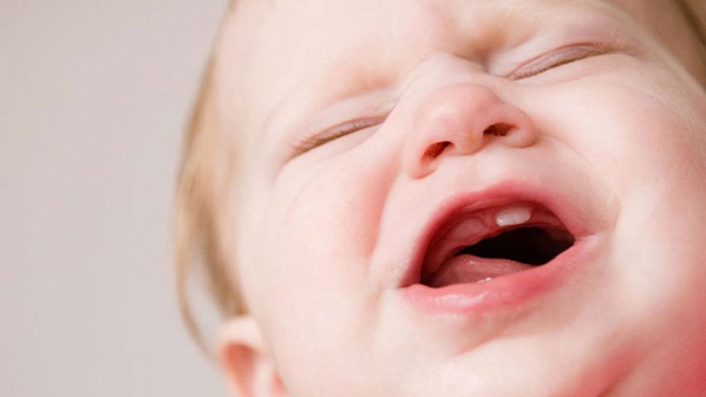 Cuando pase un tiempo habrá que cepillar los dientes con un paño frío.