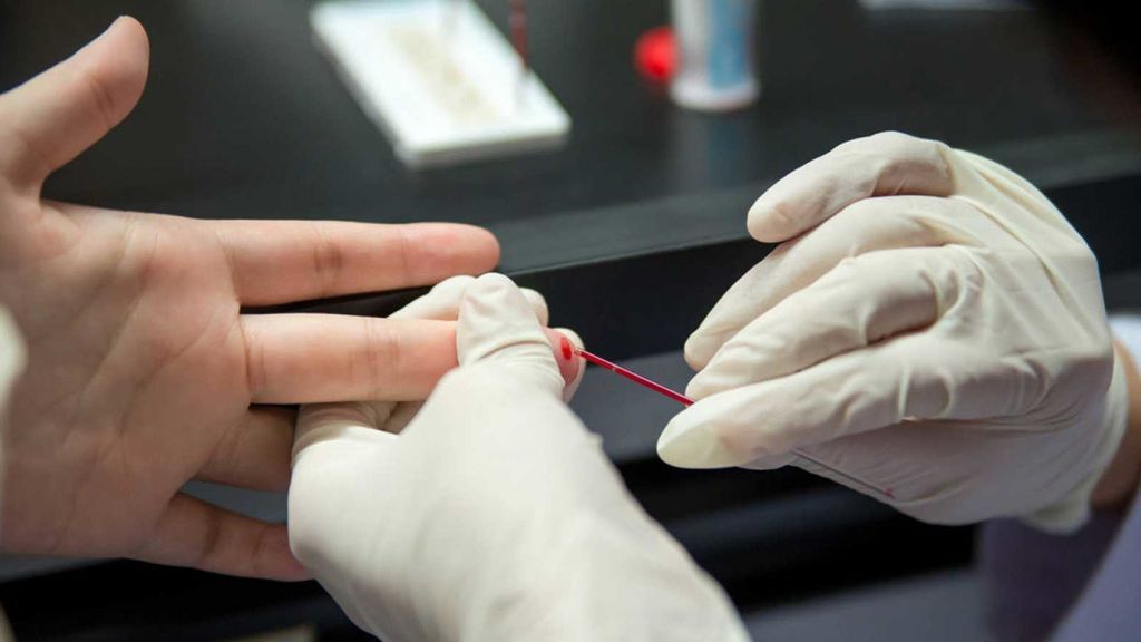 Efectos de la COVID-19 en el Sida: menos tratamientos y diagnósticos tardíos en España Efectos de la COVID-19 en el Sida: menos tratamientos y diagnósticos tardíos en España
