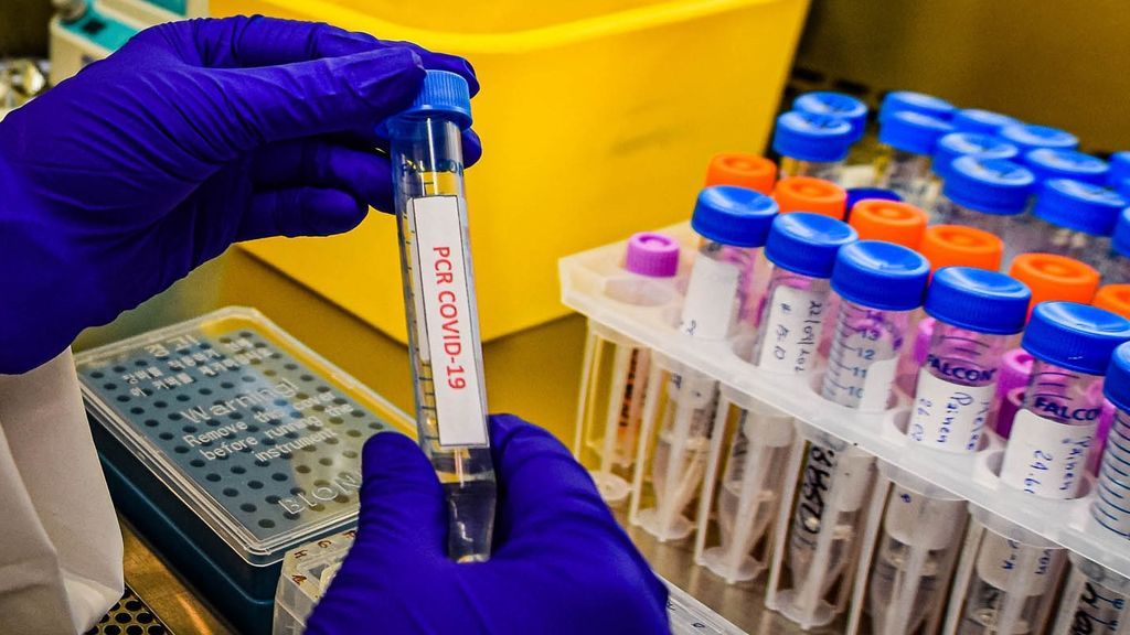 Pruebas PCR Pruebas PCR