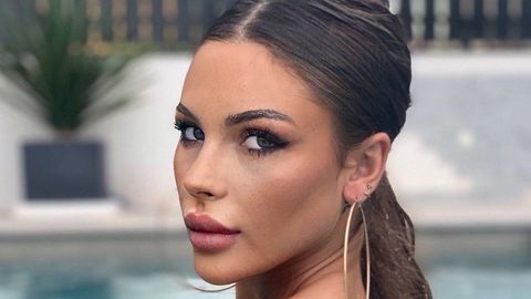 Alba Casillas (MyHyV) muestra el asombroso resultado de su operación de