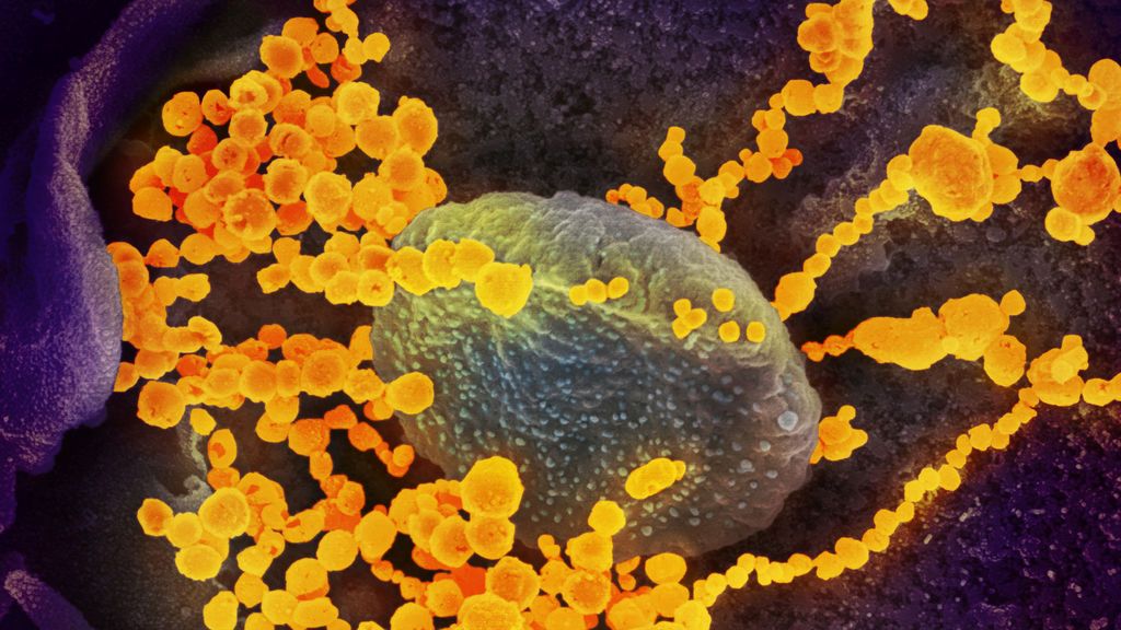Los bebés nacidos de madres coronavirus tienen anticuerpos Los bebés nacidos de madres coronavirus tienen anticuerpos