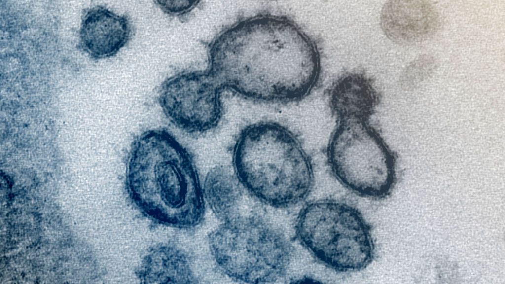 ¿Qué sabemos sobre la nueva variante del coronavirus? NIUS