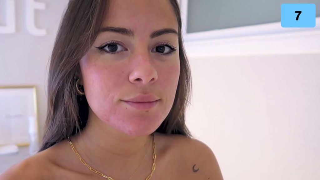 Melyssa Pinto se sincera sobre el acné que sufre (1/2)