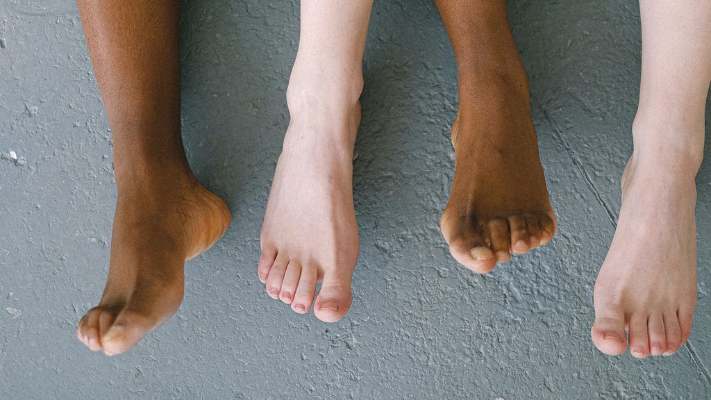 ¿Qué son los juanetes y como acabar con su dolor?