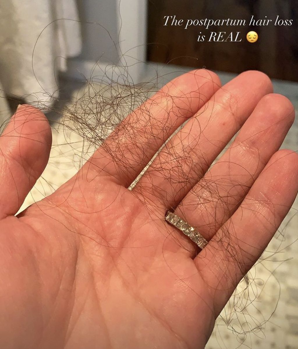 lea-michelle-muestra-perdida-pelo-posparto-650x828