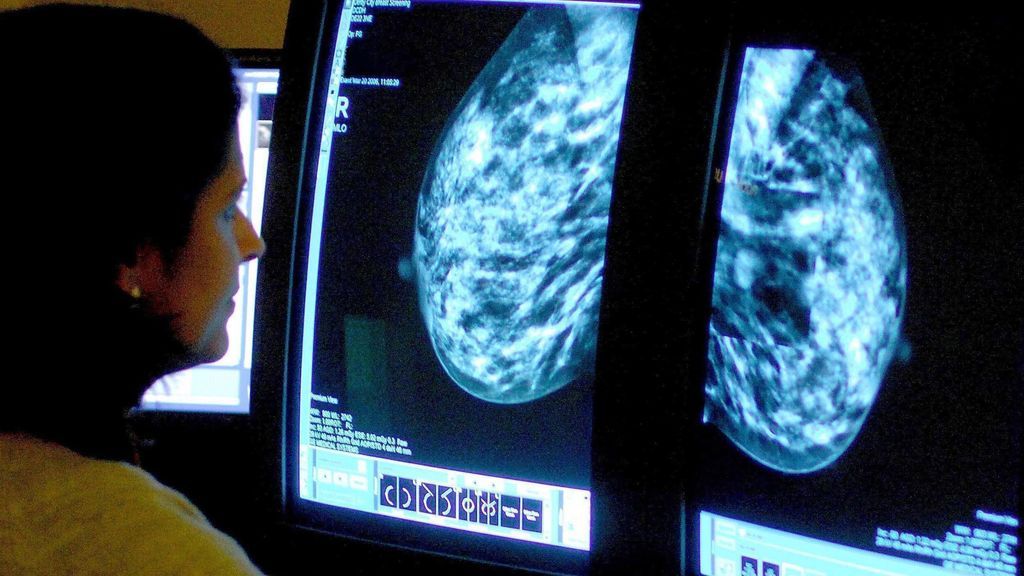 Así cambiará la medicina para combatir el cáncer en los próximos años