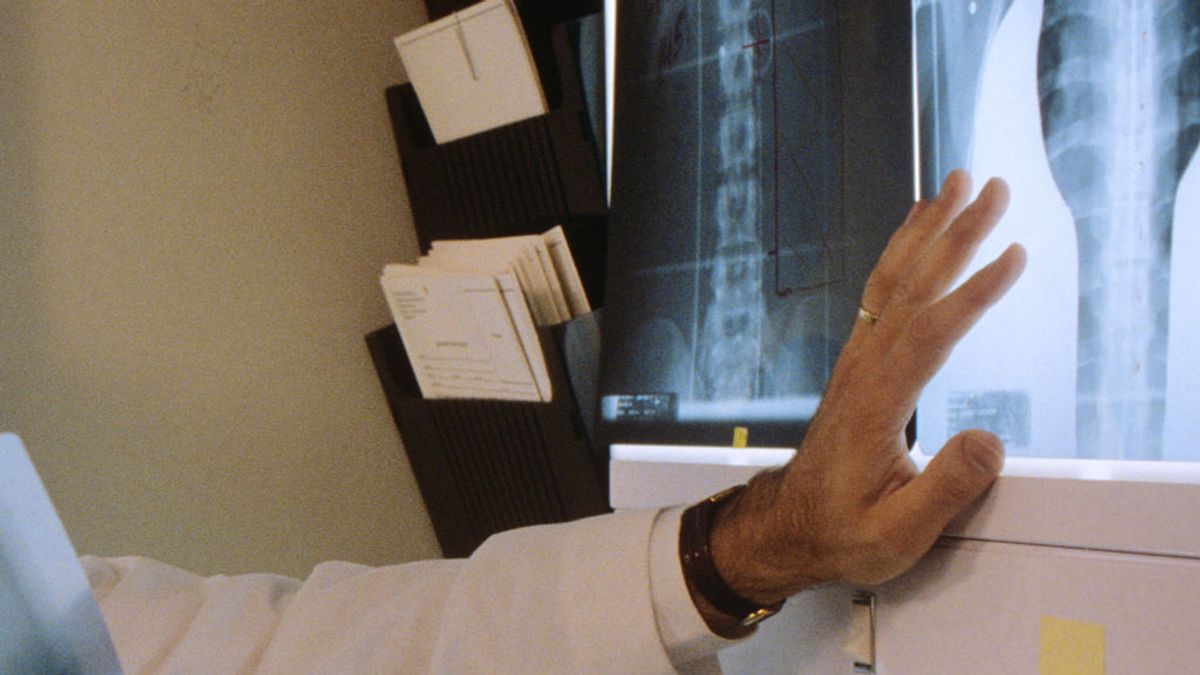 Una traumatóloga advierte con radiografías: "Los pulmones poscoronavirus se ven peor que los de cualquier fumador"