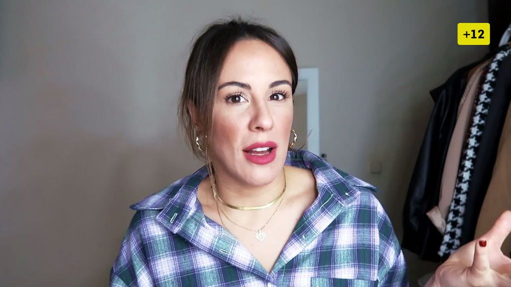 Susana Megan habla del complejo que sufre con los granos y enseña su cara sin filtros ni maquillaje (2/2)
