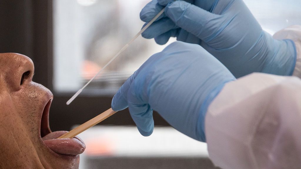 La "lengua covid" se suma a la lista de síntomas del coronavirus La "lengua covid" se suma a la lista de síntomas del coronavirus
