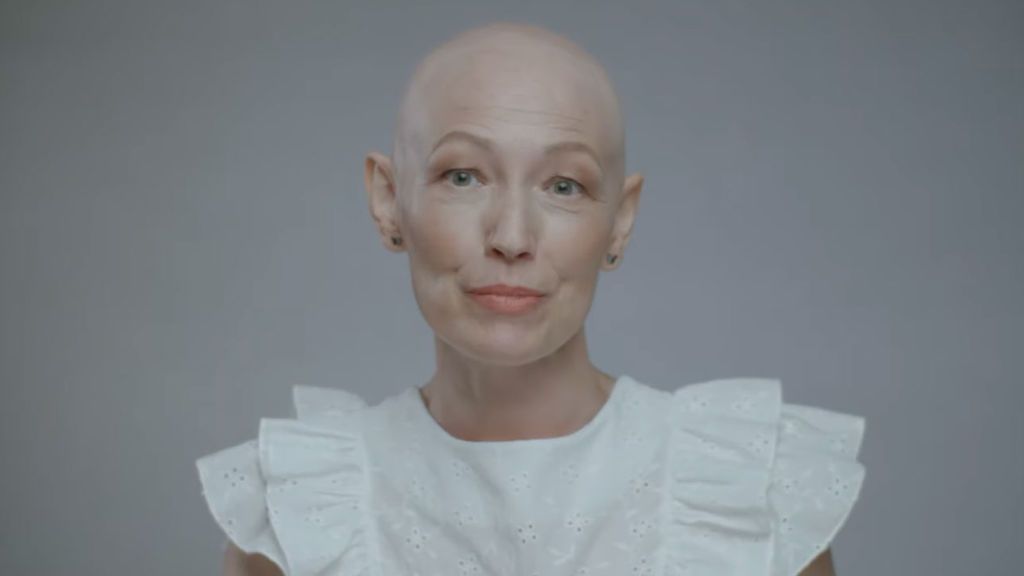 Calvas y Bellas, un documental sobre la alopecia de la quimio