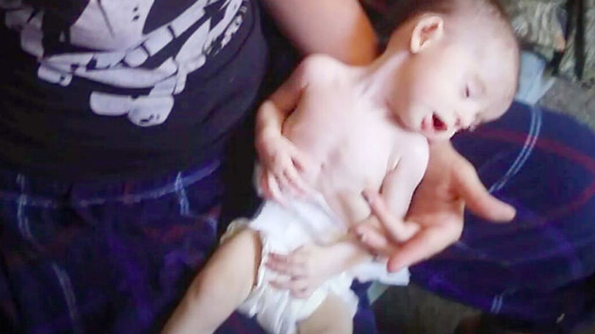 Un policía rescata a un bebé en los huesos en  y 3 años después su transformación es asombrosa