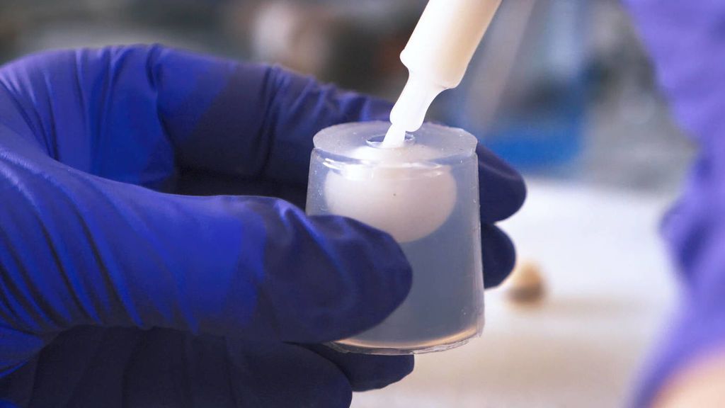 El profesional desesterilizará la leche materna.
