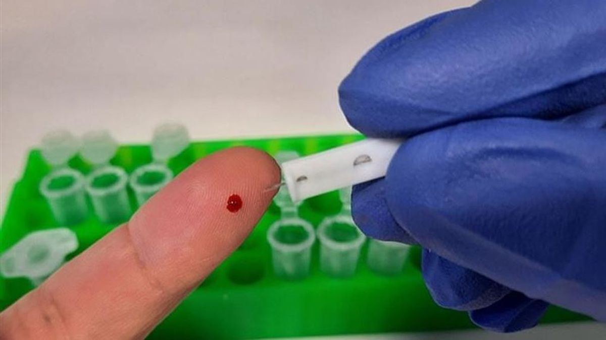El CSIC diseña un test de anticuerpos de covid más sensible y fiable al 99% que solo necesita una gota de sangre