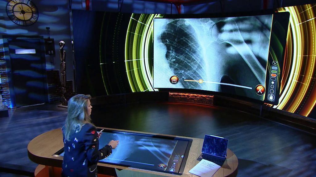 Las fotos de los espectadores Las fotos de los espectadores