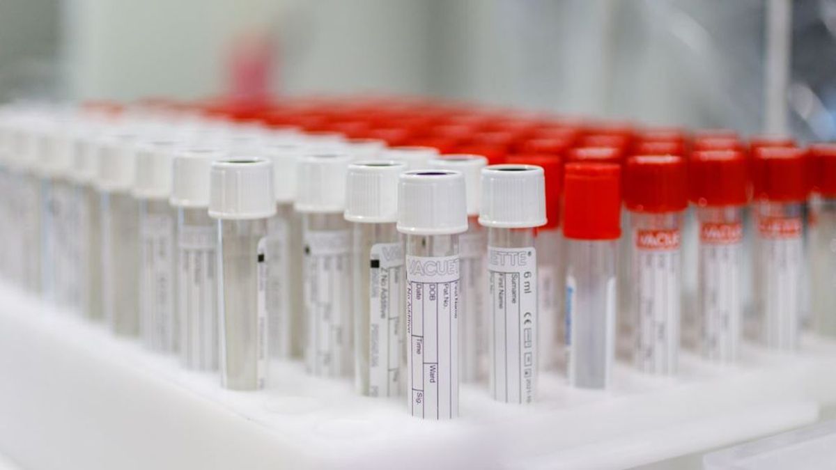 Sanidad anuncia que la vacuna de Janssen, de una sola dosis, puede llegar en marzo a España Sanidad anuncia que la vacuna de Janssen, de una sola dosis, puede llegar en marzo a España