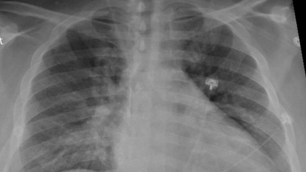 Científicos valencianos organizan un 'challenge' para enseñar a detectar covid a inteligencias artificiales Científicos valencianos organizan un 'challenge' para enseñar a detectar covid a inteligencias artificiales