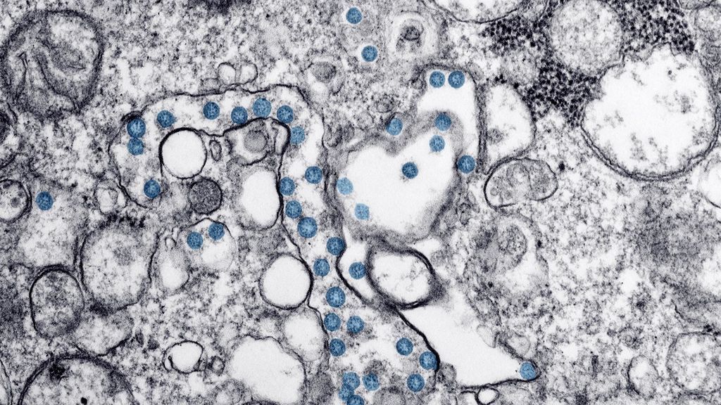 El CSIC obtiene un nanomaterial que elimina el coronavirus y es aplicable en mascarillas y tejidos El CSIC obtiene un nanomaterial que elimina el coronavirus y es aplicable en mascarillas y tejidos