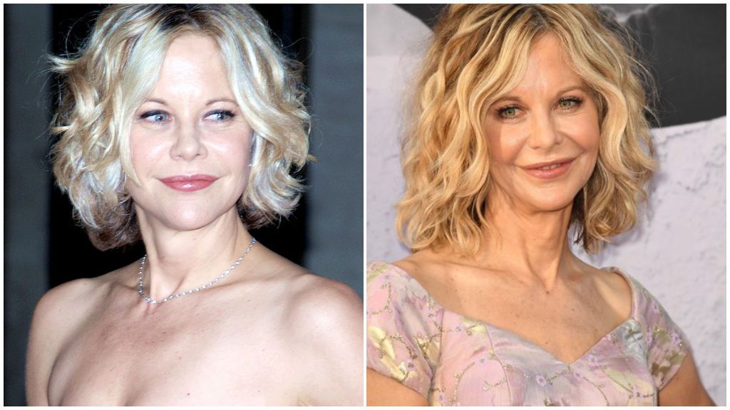 Meg Ryan se ha retocado los pómulos, la nariz y los labios.