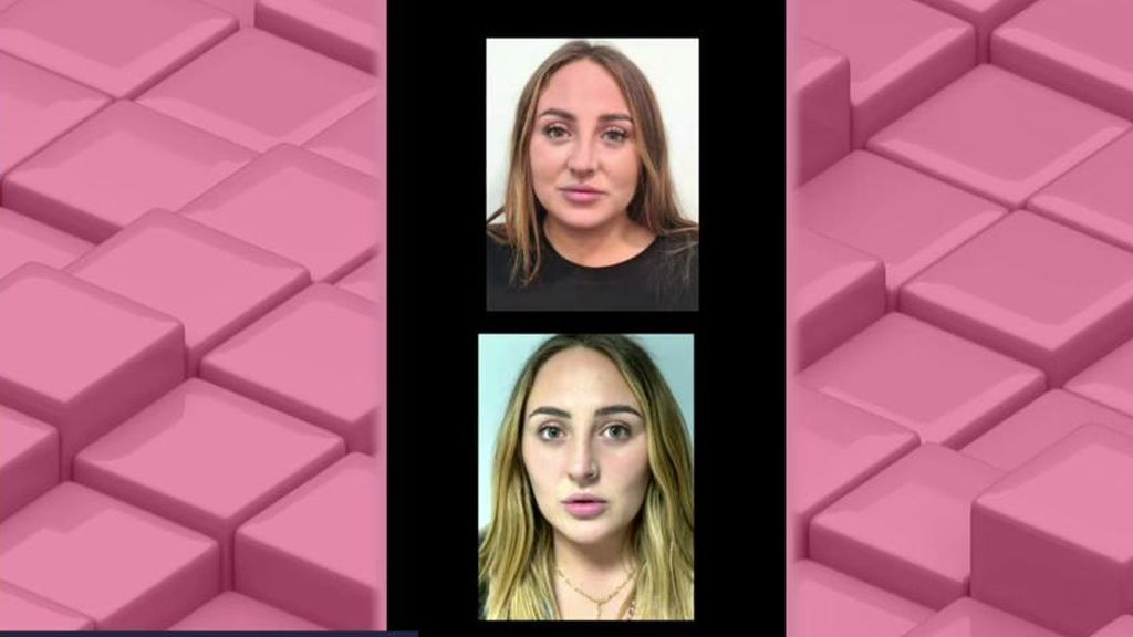 [13:54] Patricia Fernandez Sanz     Rocío Flores se opera la cara: el increíble antes y después tras someterse a una Bichectomía