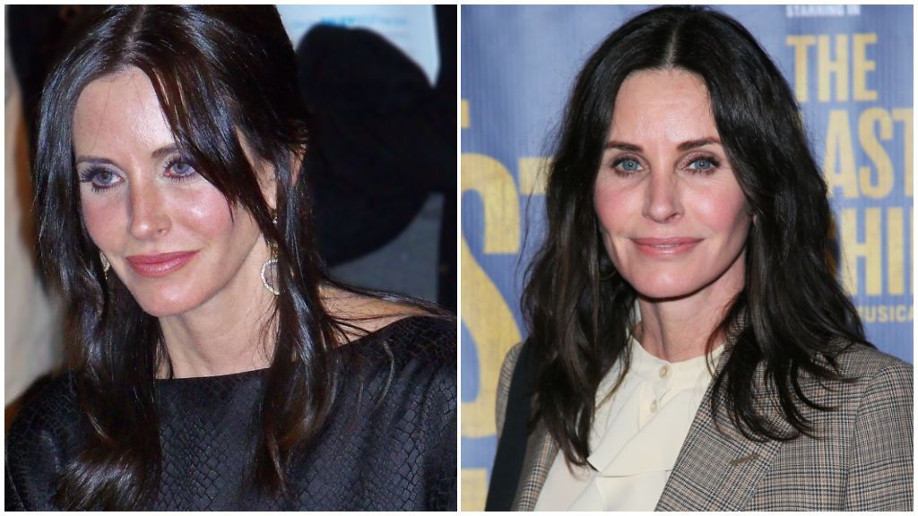 Courteney Cox también ha pasado, en más de una ocasión, por quirófano.