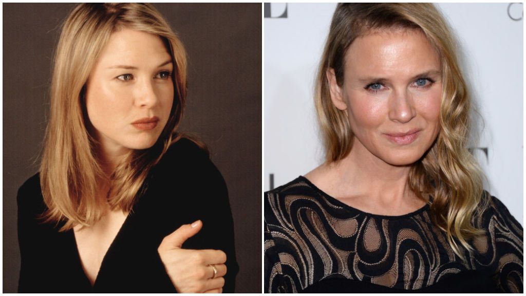 Renée Zellweger se hizo viral por su cambio de rostro.