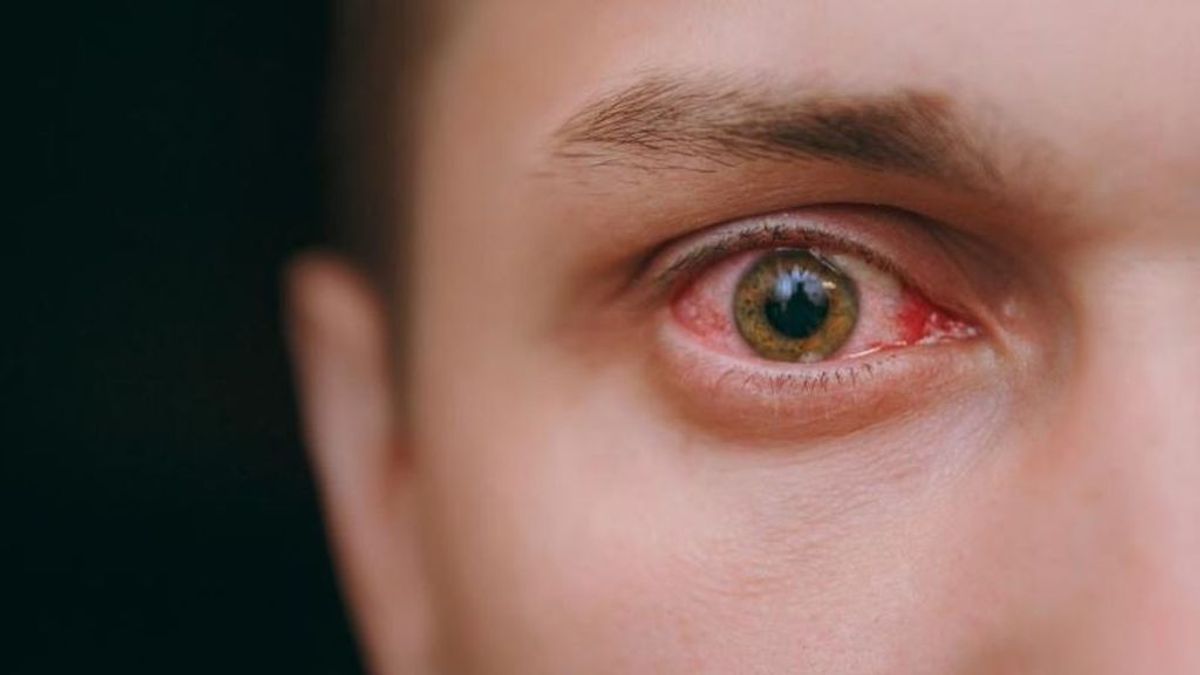 La covid-19 también provoca anomalías oculares