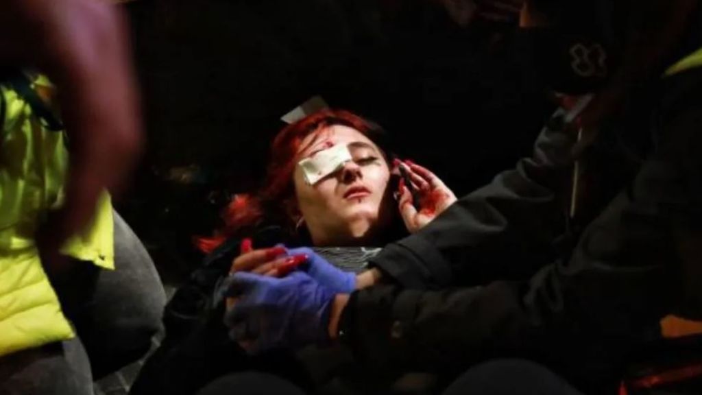 Una herida en las violentas protestas por el encarcelamiento de Hasel pierde un ojo
