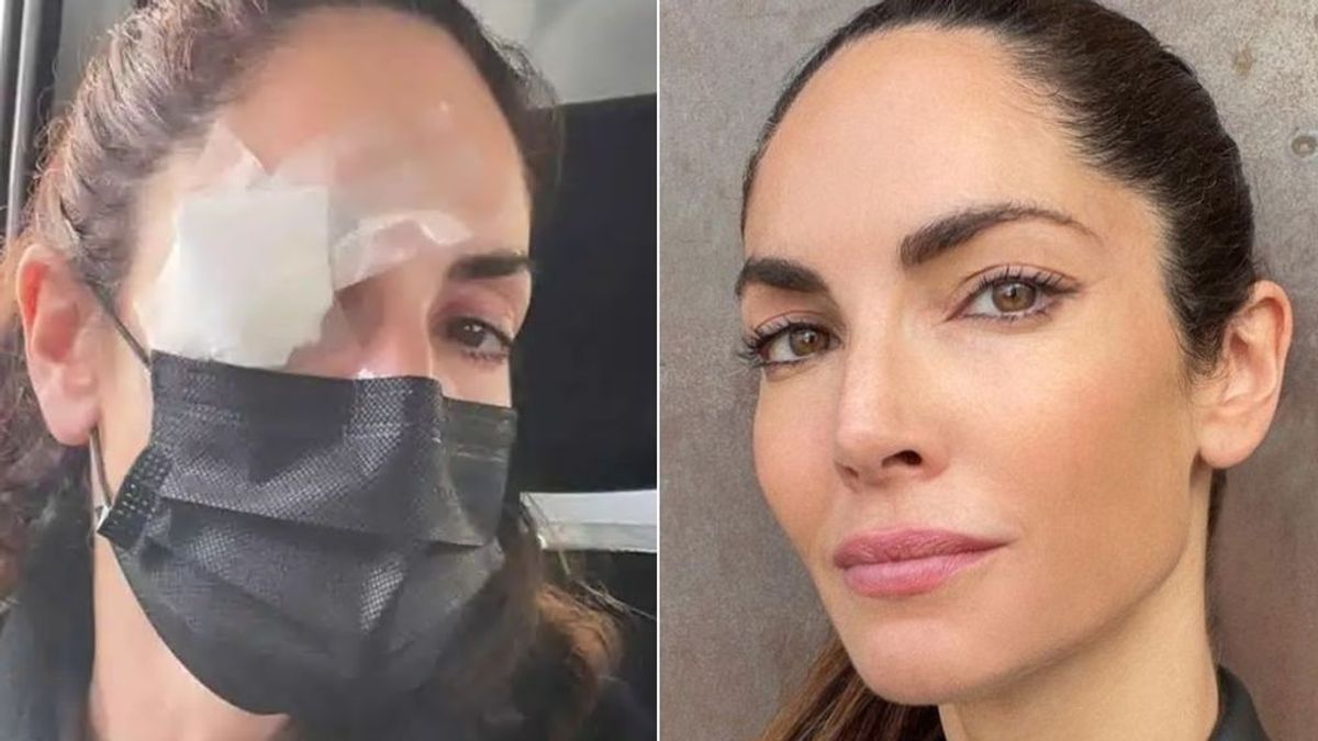 Eugenia Silva preocupa a sus fans tras someterse a una intervención en el ojo