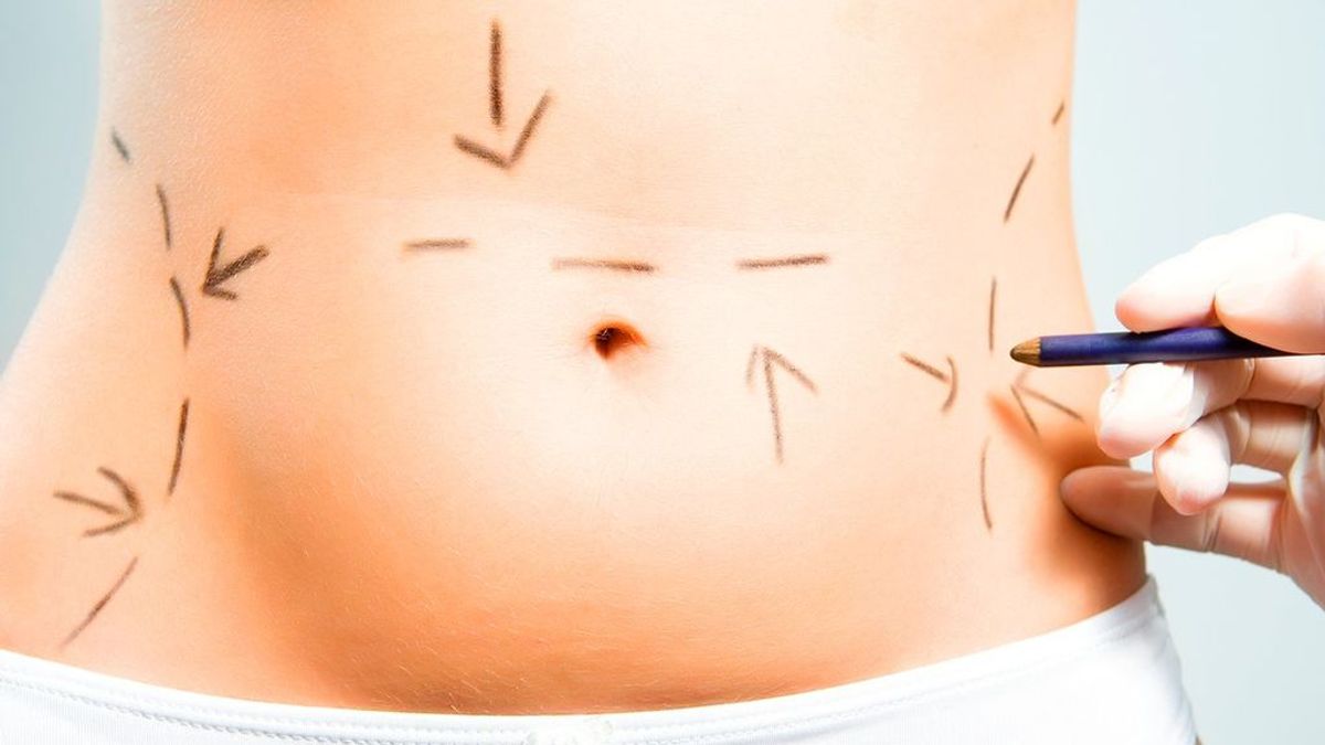 Abdominoplastia, una operación estética muy común para recuperar la figura tras el parto: estas son las recomendaciones de una experta.