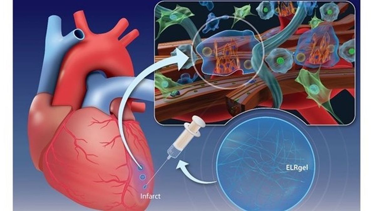 Investigadores españoles desarrollan un hidrogel capaz de regenerar el tejido cardíaco después de un infarto
