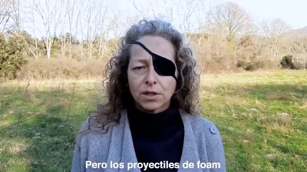 Manifestantes catalanes que perdieron un ojo piden prohibir las balas de 'foam': "¿Cuántos heridos más necesitan?" Manifestantes catalanes que perdieron un ojo piden prohibir las balas de 'foam': "¿Cuántos heridos más necesitan?"