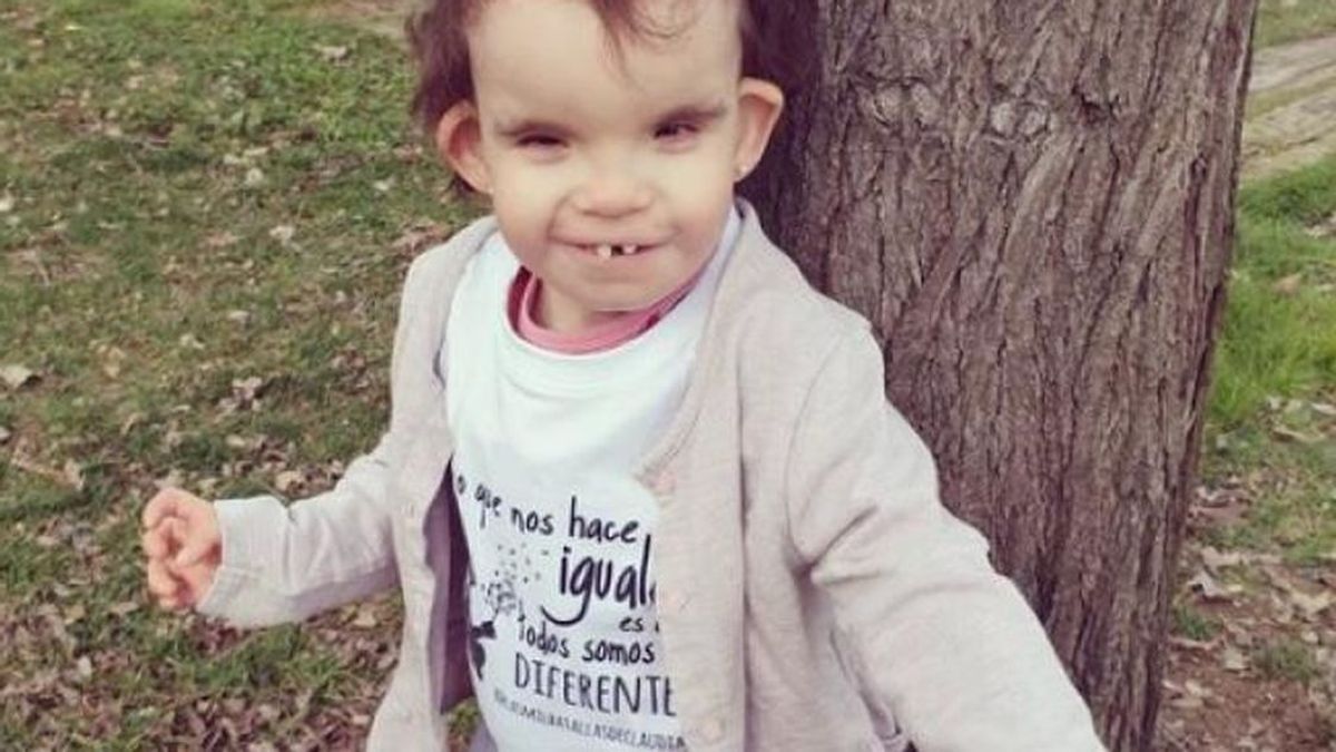 El caso de Claudia, la primera niña en España con síndrome de Menke-Hennekam