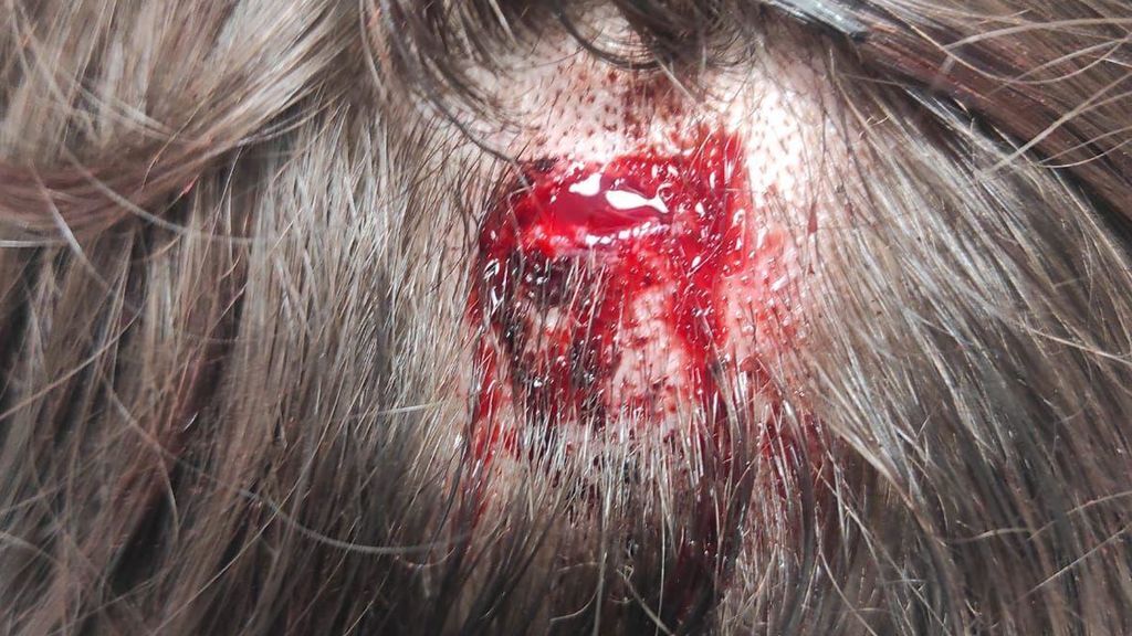 golpe cabeza malaga adolescente