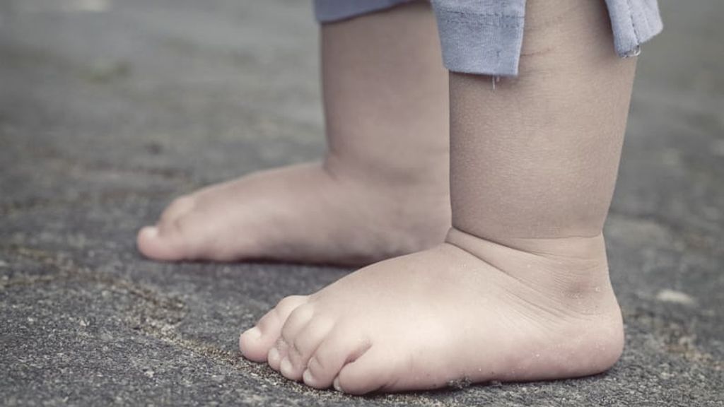 Pies planos en niños, un problema común que debe corregirse a tiempo: cómo saber cuándo es el momento de acudir al pediatra.