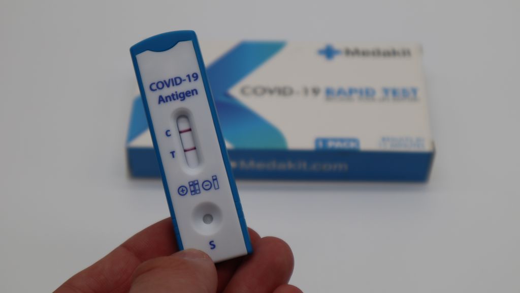 test-antigenos