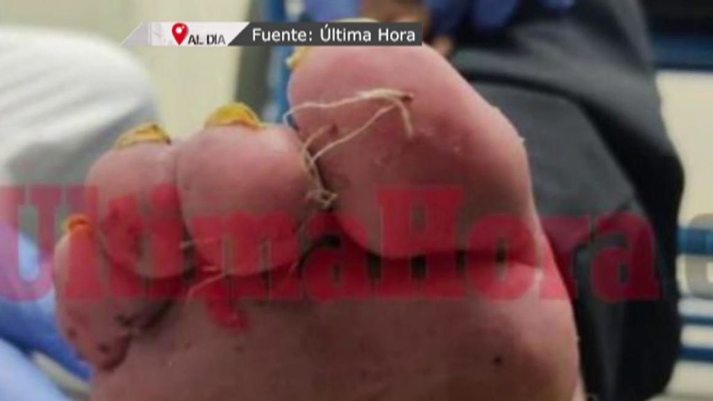 Imágenes de las torturas al descapacitados Imágenes de las torturas al descapacitados